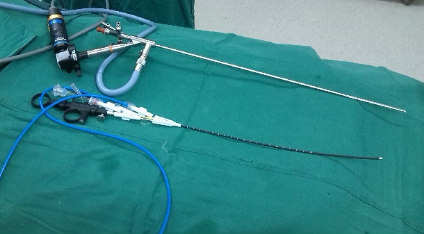 纤维输尿管镜和 标准 纤维输尿管镜手术流程