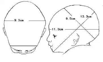 胎儿头部径线示意图图片