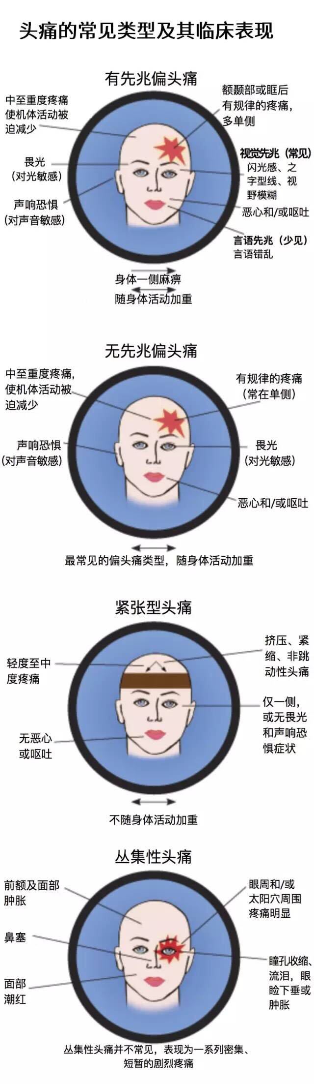 一图读懂常见的头痛类型转载