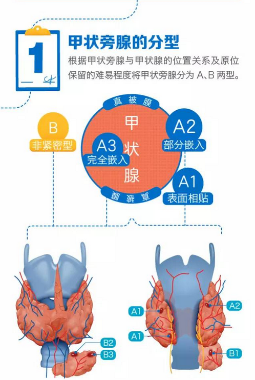 甲状旁腺大小图片