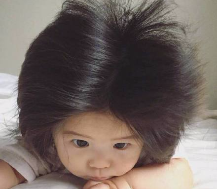 为什么有的宝宝出生就头发浓密,有的很稀疏?不完全由遗传决定!