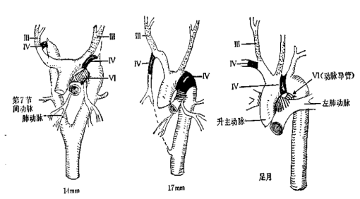 醫學科普主動脈弓部發育及變異
