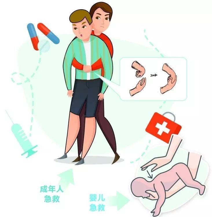 heimlich maneuver图片