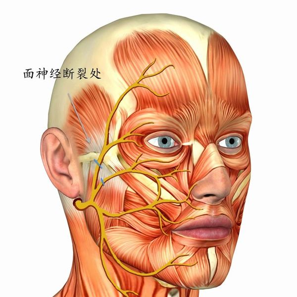 面部神经分布图高清图图片