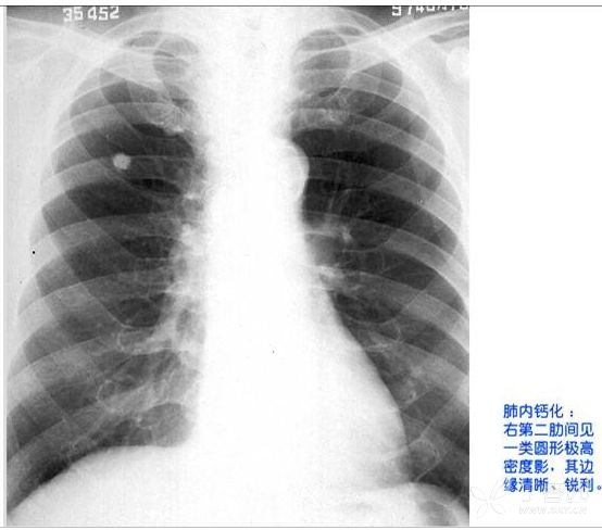 x线双房影图片图片