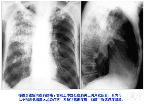 x线双房影图片图片