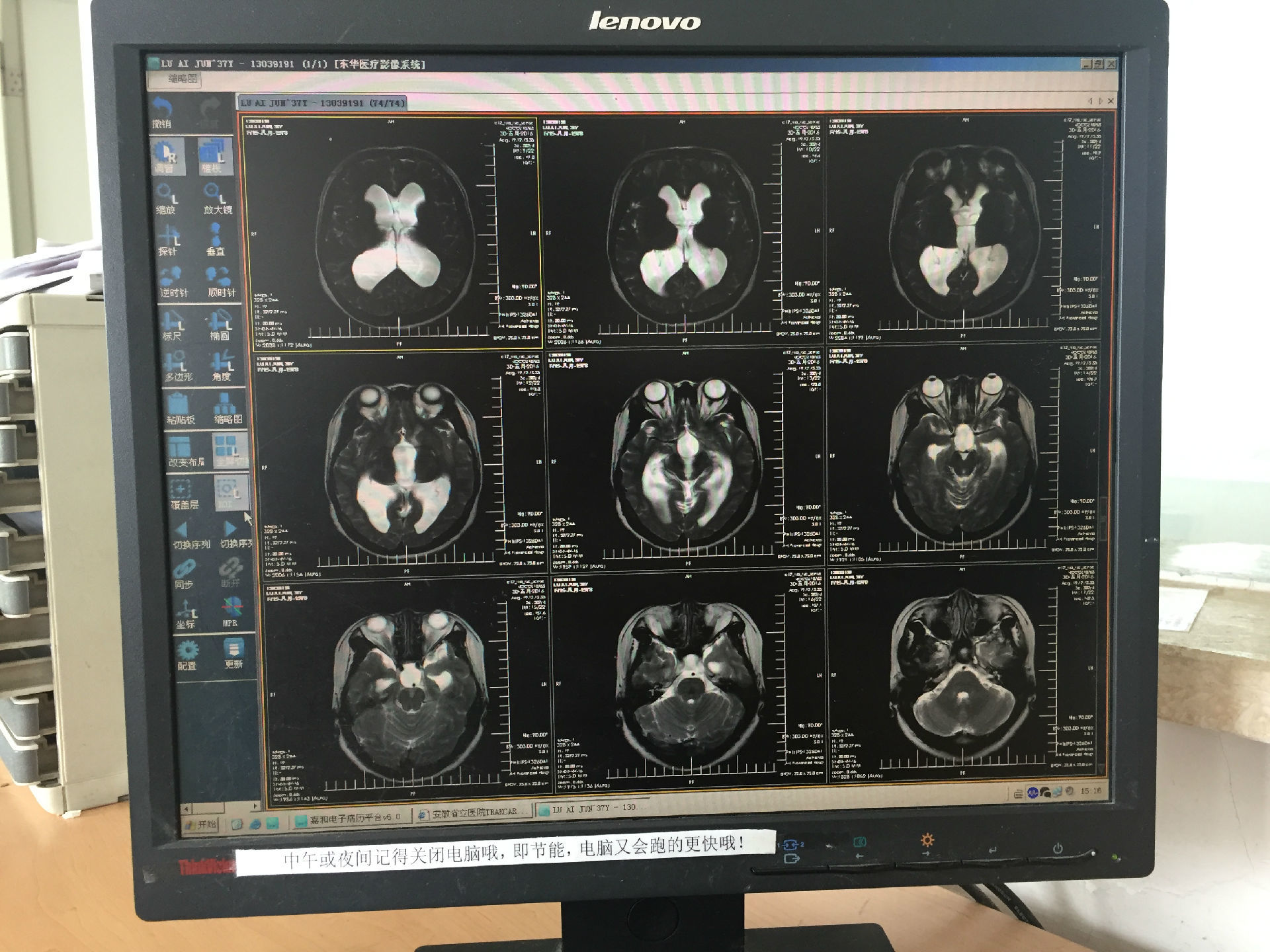 如何拍一份醫生滿意的影像資料(ct和磁共振等)_片子