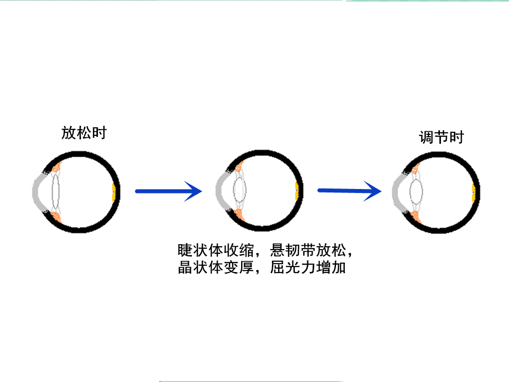 當需要看近處的物體時,眼睛的睫狀肌會收縮,使晶狀體懸,繼而晶狀體