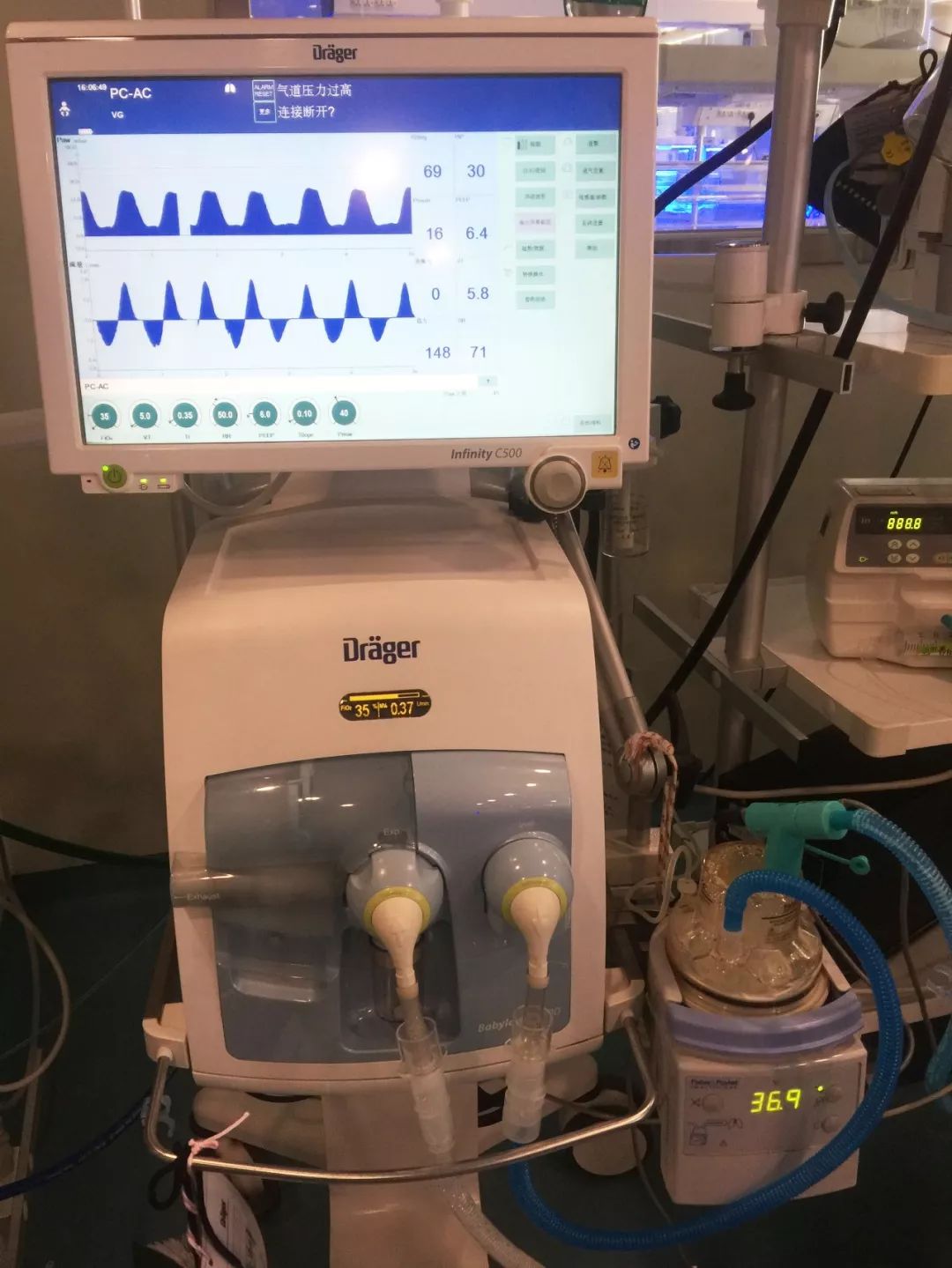 新生儿上呼吸机图片