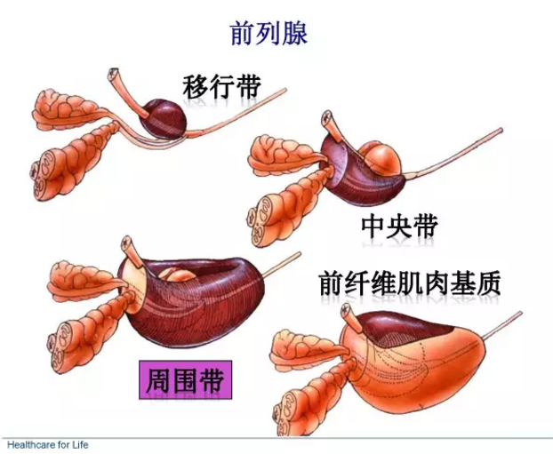 朱刚我们所知道的前列腺癌