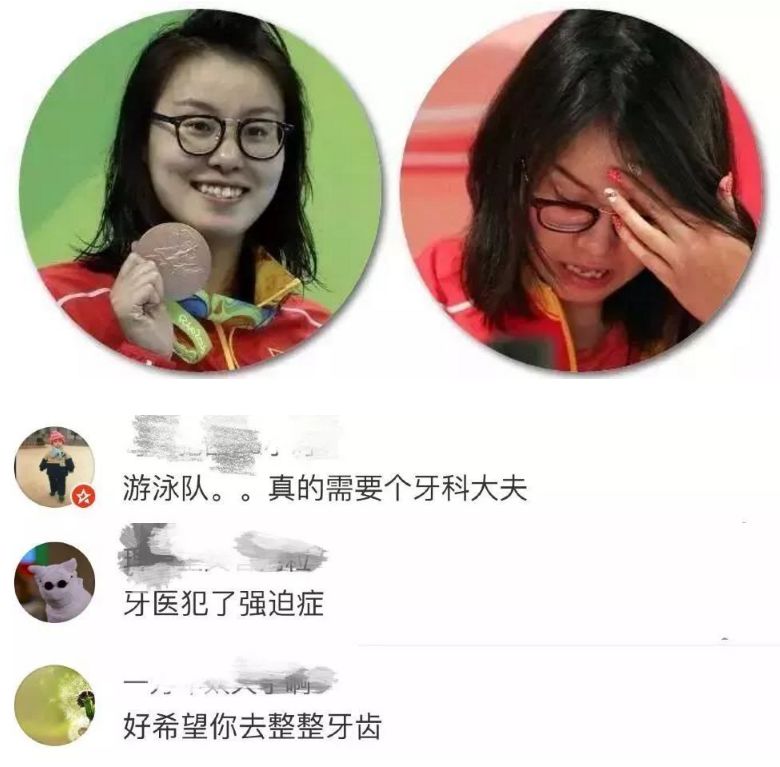 後來傅園慧小姐姐真的去矯正了牙齒!矯正之後的傅園慧是這樣的!