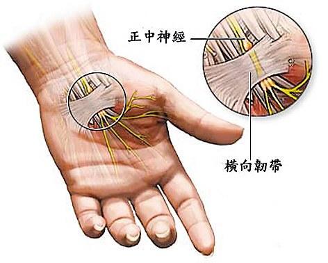 正中神經控制拇指,示指,中指和部分環指的感覺,並支配一些小手肌肉