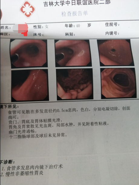 胃镜病理报告单图片