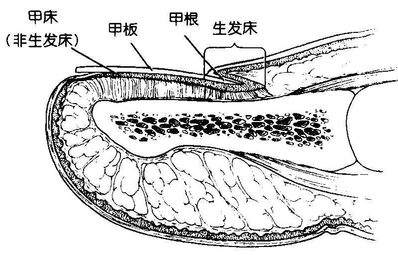 边缘生发床失去原有的逐渐变薄生理结构,新长甲板的边缘将不再圆润