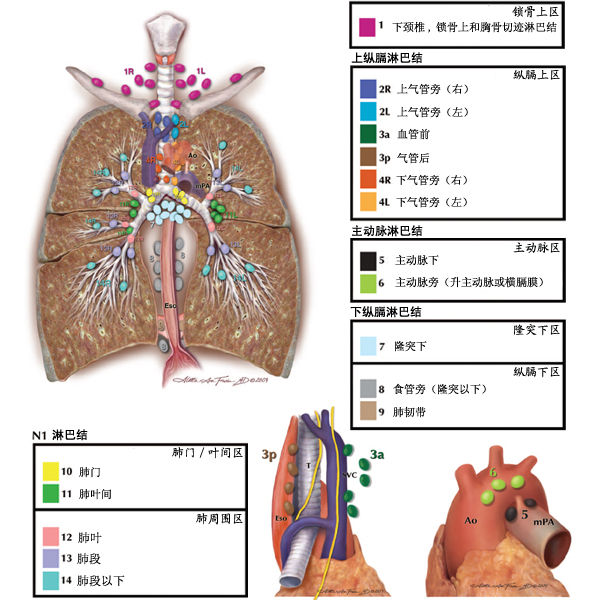 肺淋巴结分组解剖图谱图片