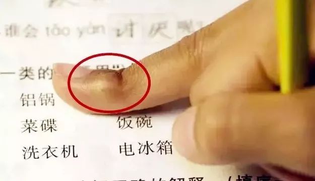 看到上面的握笔茧了么?你有没有过?正确的握笔姿势是什么?看下图!