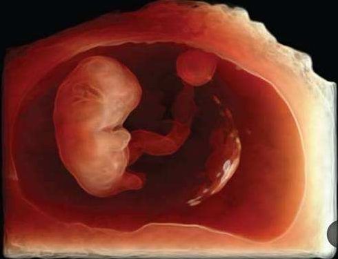 80天的胎儿有多大图片