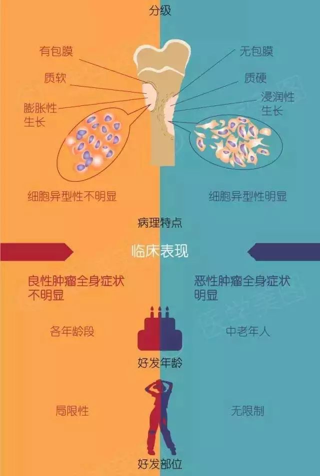 看图识别良性肿瘤和恶性肿瘤