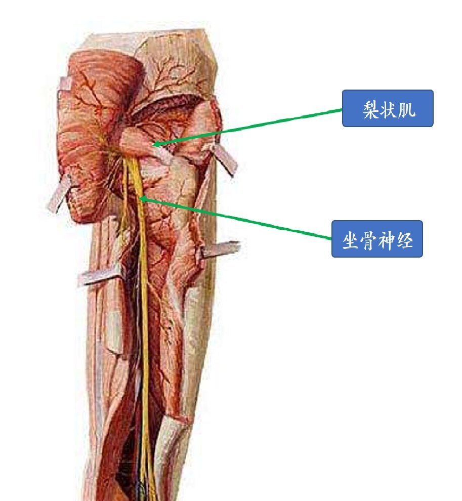 梨状肌综合症艾灸图图片