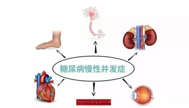 糖尿病并发症保险都有哪些 糖尿病并发症保险