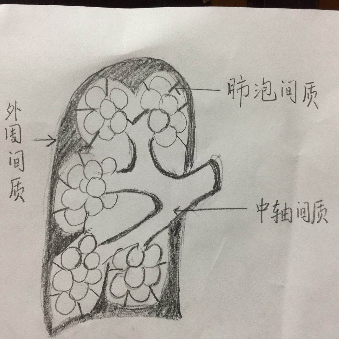 肺泡间孔cohn孔示意图图片