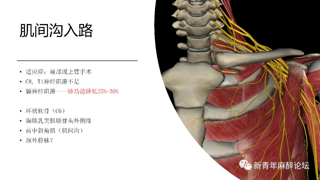 上肢神經解剖與超聲引導神經阻滯