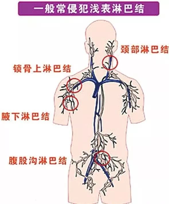 淋巴系统分布图高清图片