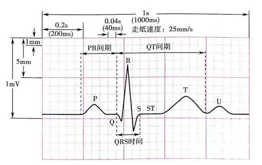 心电图的正常值范围图片