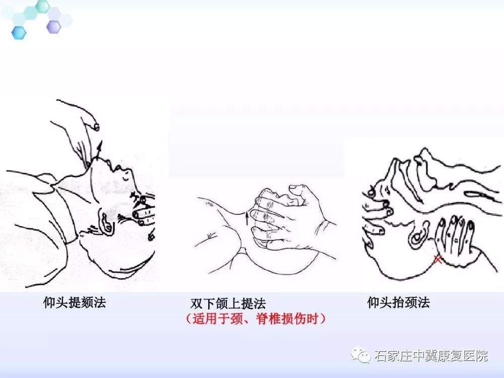 心肺复苏流程图卡通图图片