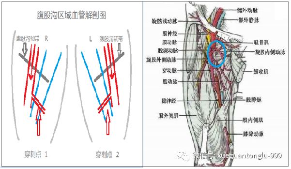 股静脉穿刺解剖图片图片