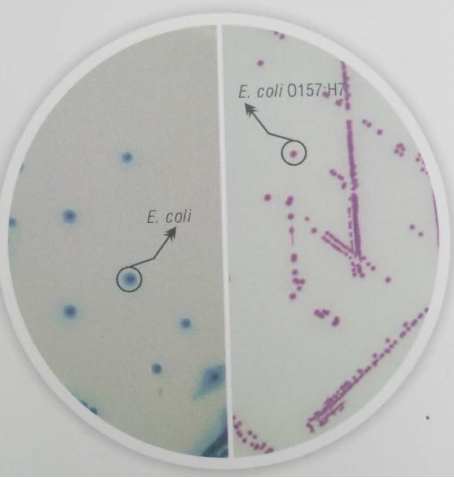 分离大肠杆菌o157:h7可选用的培养基