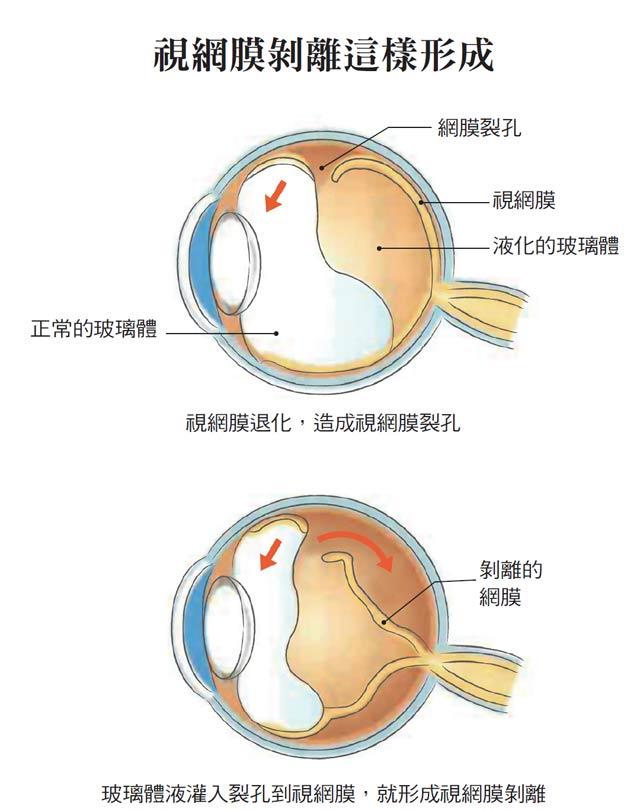 落日眼图片是什么样子图片