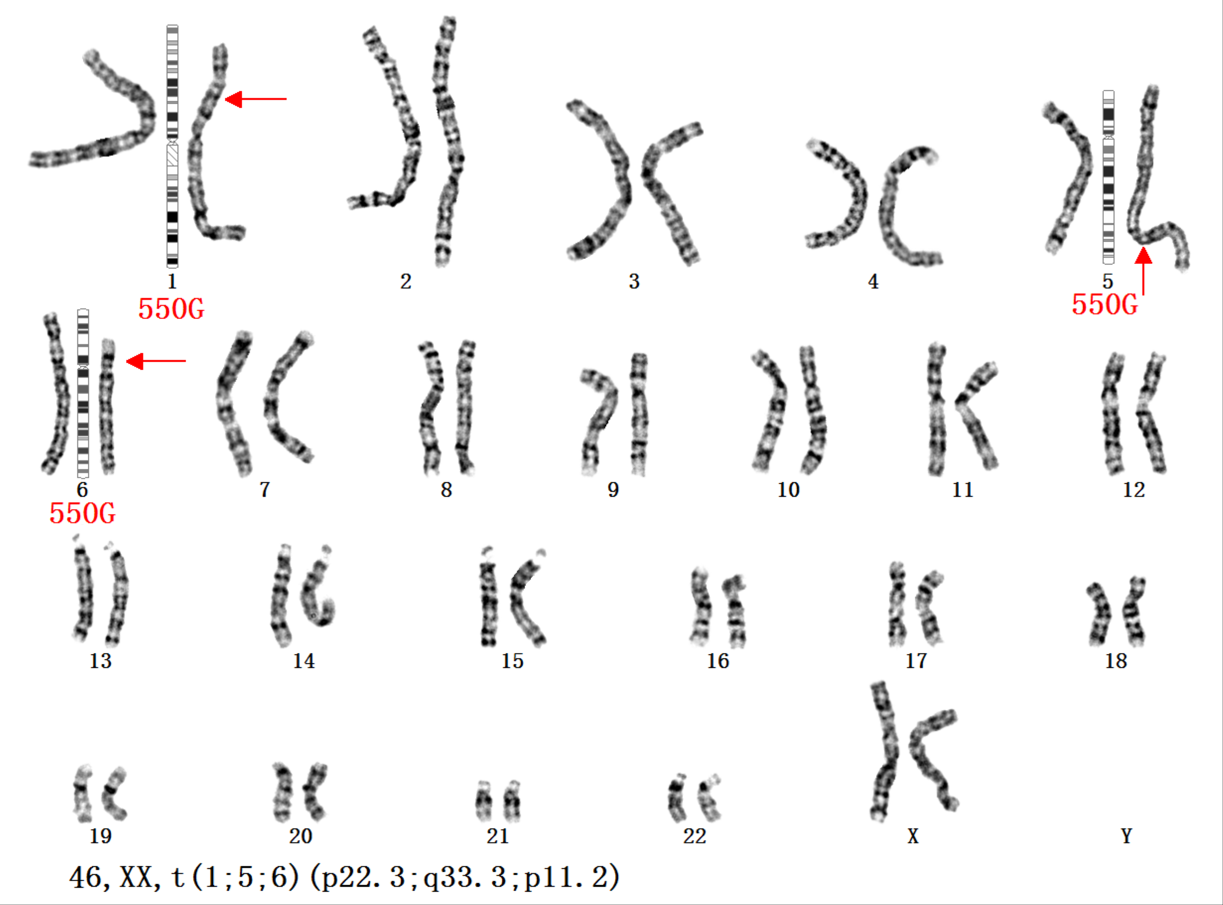 染色体断裂图片