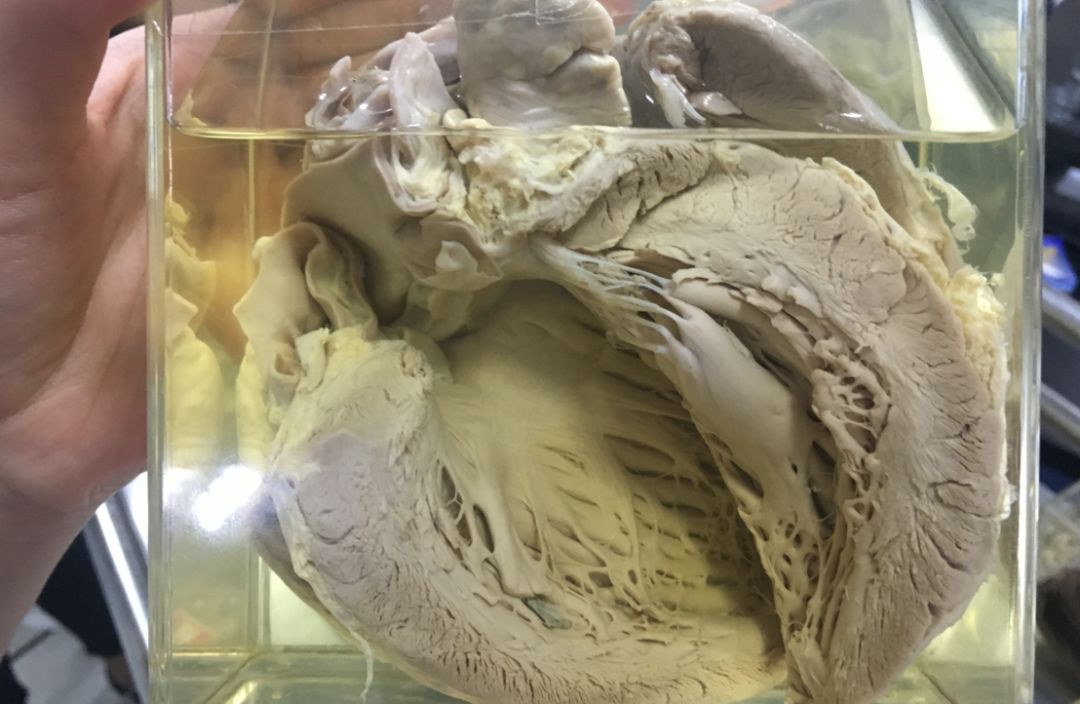 福尔马林泡的器官图片