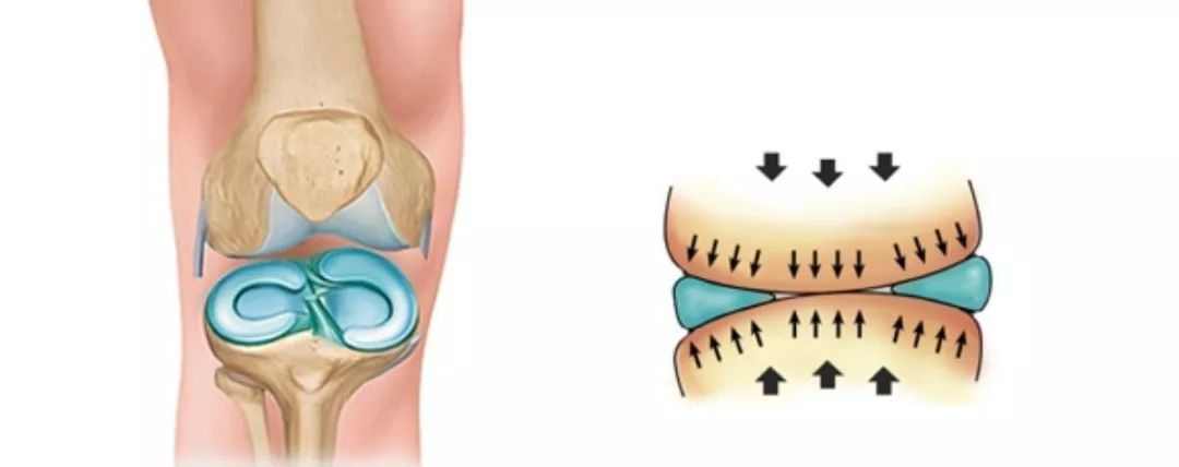 半月板損傷了怎麼辦華山醫院運動醫學專家為你解答