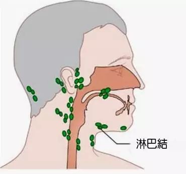 孩子反覆肚痛警惕腸繫膜淋巴結炎