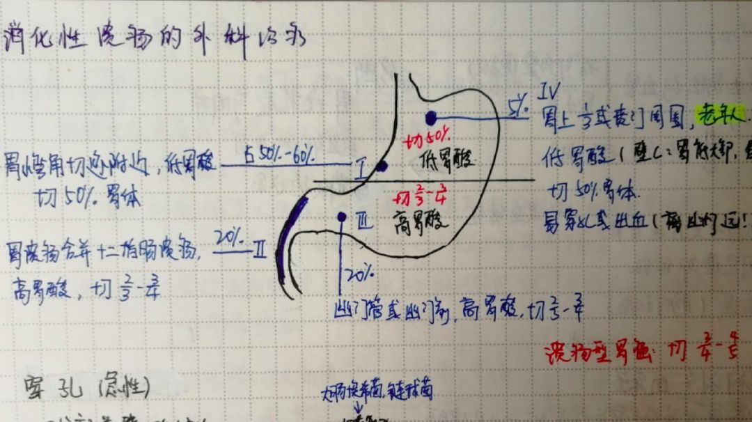 回肠末端与邻近右侧结肠多见,病变节段或跳跃性,呈缝隙状(线样征,木梳