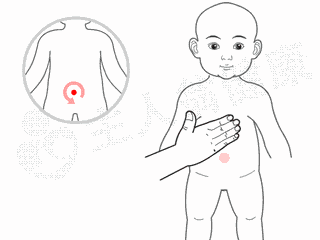 宝宝腹泻辨证论治寒湿腹泻的推拿与饮食调理