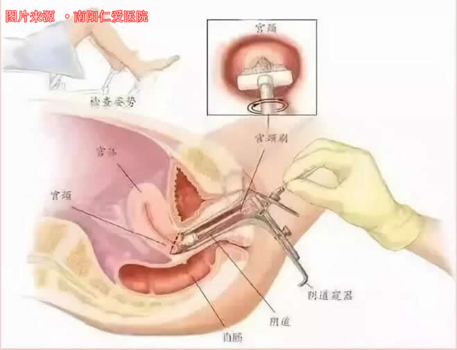 女人下面豆腐渣 东西图片