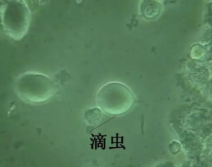 革兰氏染色镜检:可直观地在油镜下检出如加德纳菌/普雷沃菌,形似动弯