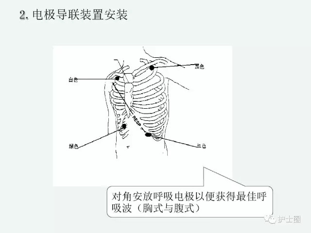 心电监护仪放置位置图图片