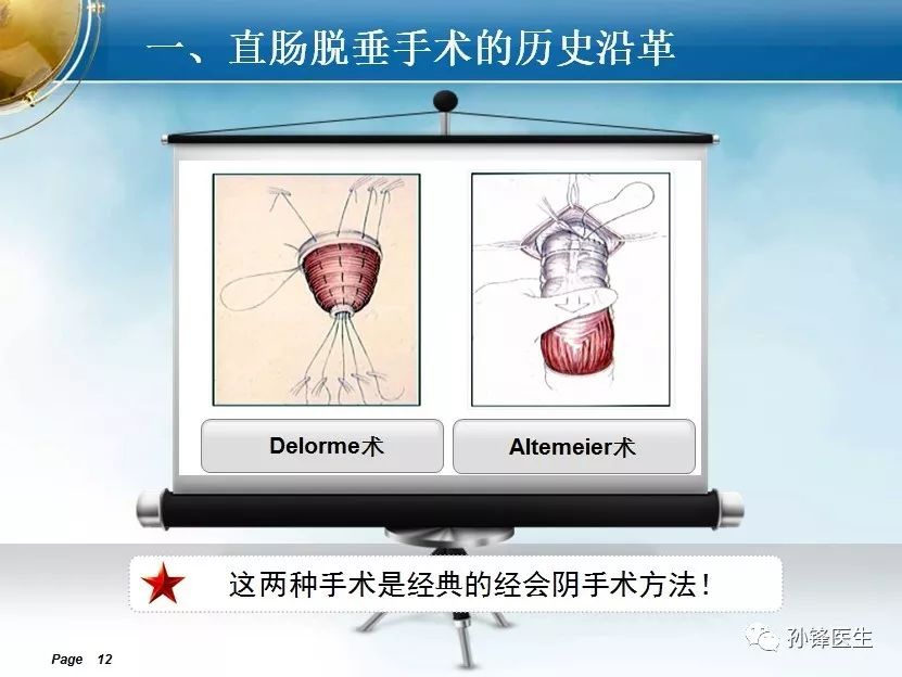 会场速递直肠脱垂手术的演变与选择