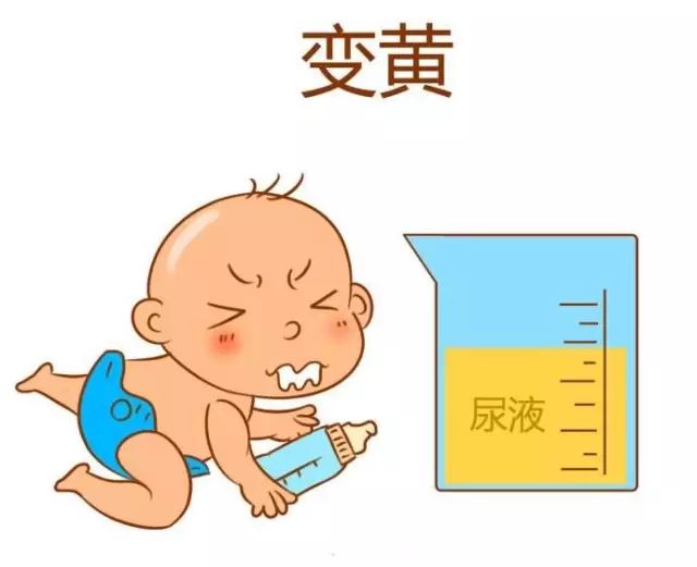 刚出生的宝宝尿色发黄,通常是由于新生儿黄疸疾病所致,除此表现外