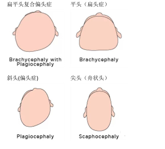 扁头好看还是圆头好看?到底要不要给宝宝刻意睡头型?