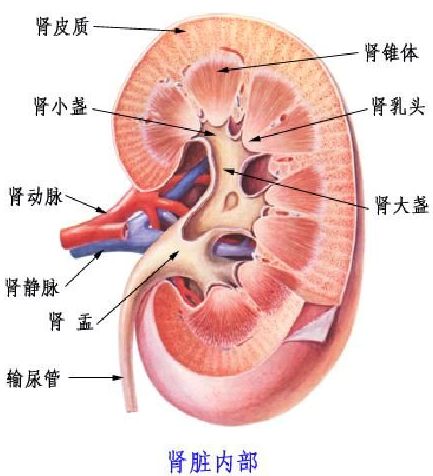 肾乳头坏死图片