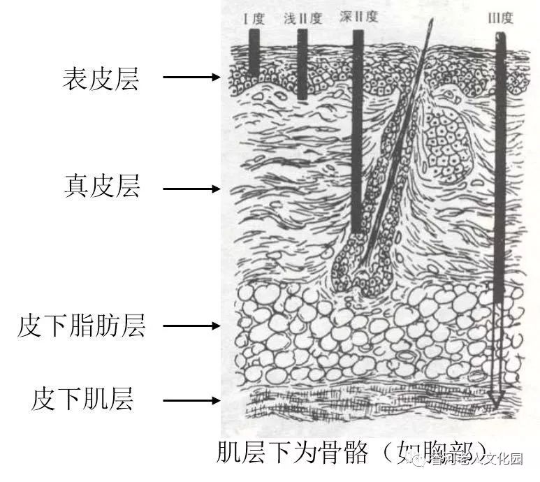 人体皮肤组织结构通常分为四层:包括表皮层,真皮层,皮下脂肪层和肌层