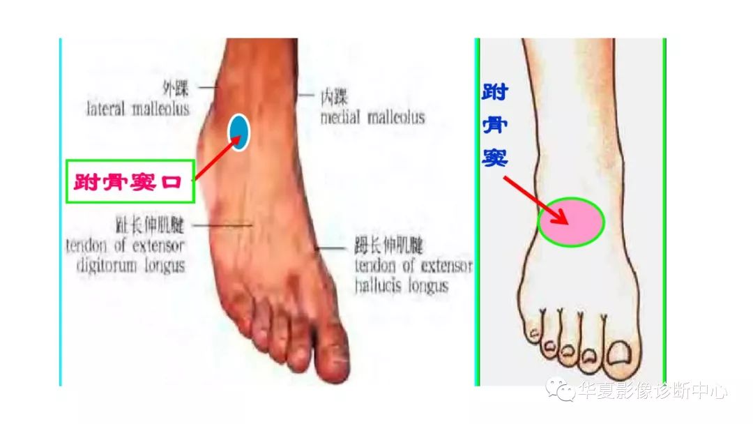 右脚的结构图图片