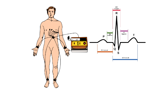 医院里最常用的 12 导联心电图,就是在人体上布置 10 个电极采集点