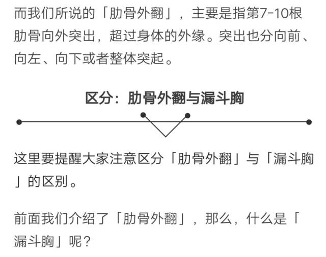 50人都有的肋骨外翻教你9招矫正它