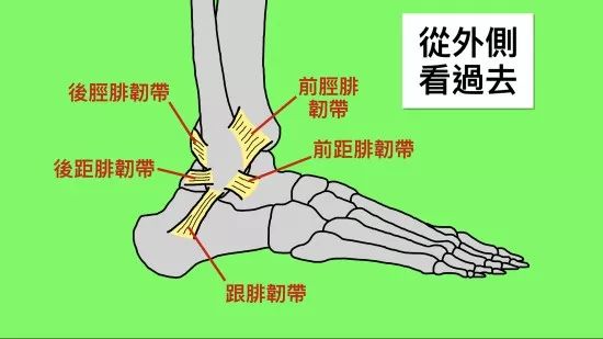 脚踝扭伤后韧带长期未痊愈可能引发的问题